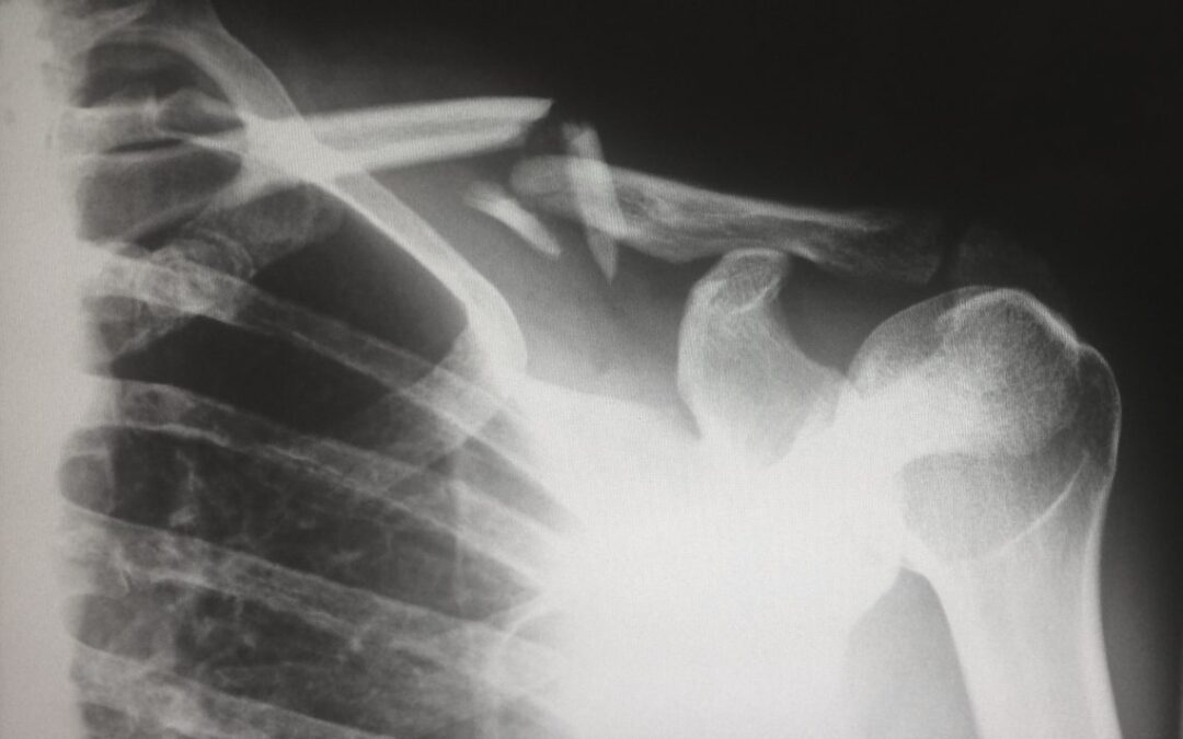 Signs You May be a Hypochondriac